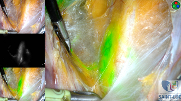 Ggl sentinelle colorant vert fluo redim site_1.png