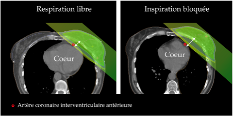 figure 1_IRA2 redim.png