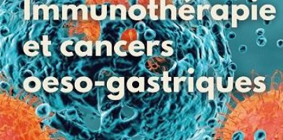 Immunothérapie et cancers oeso-gastriques site
